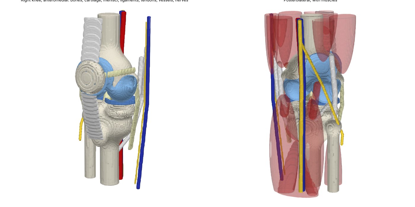 The Archetypal Knee, right side: anteromedial and posterolateral views